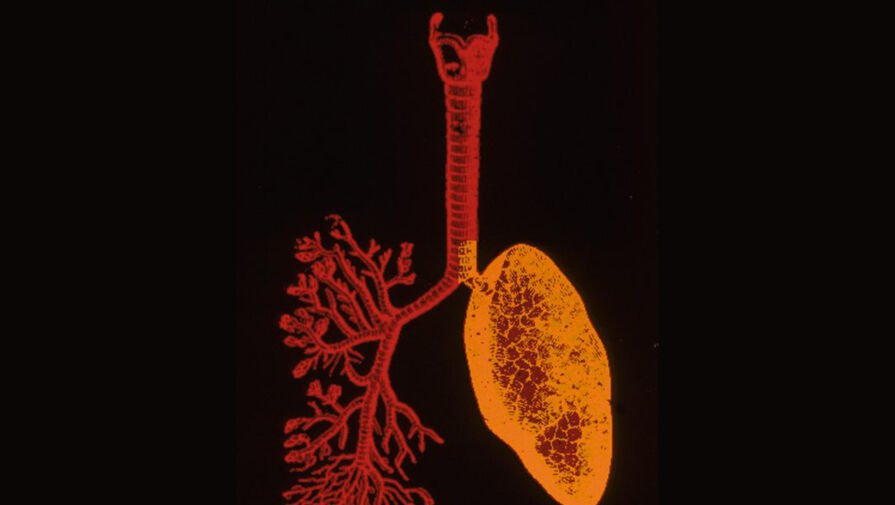 Кашель молодого мужчины оказался вызван 17-сантиметровой опухолью, упиравшейся в его легкое